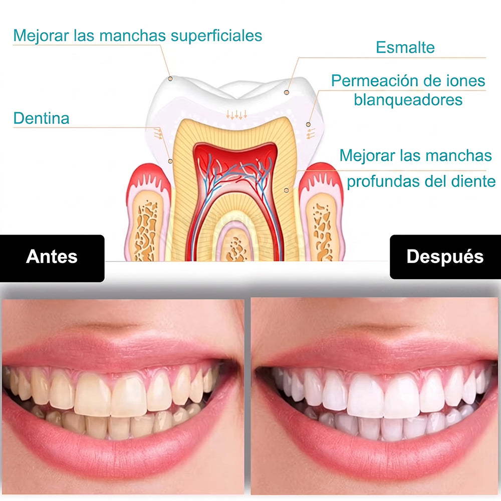 Peinebijo Kit de Blanqueamiento Dental con Luz LED y Gel 35%